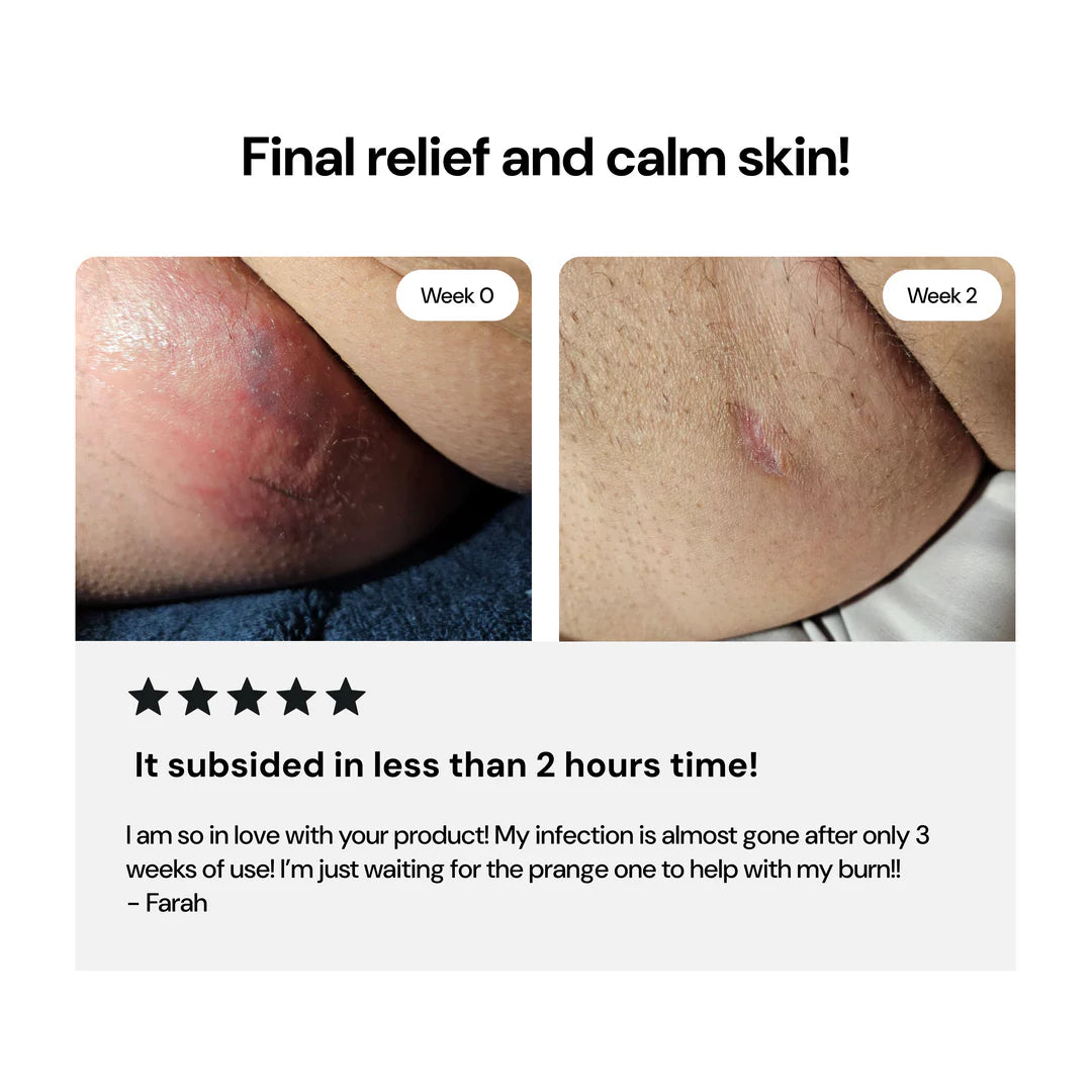 Comeback Complex Cream™